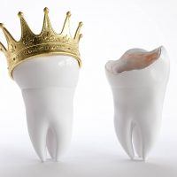 dental crown in Asheville, NC